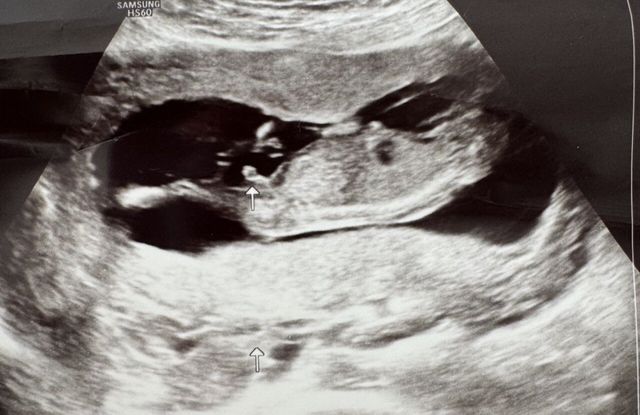 IMG_7691.jpeg 애국추 받으러 왔읍니다