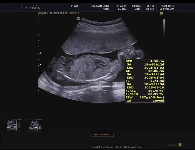 IMG_5433.jpeg 이 시국에.... 애국추 가능!?