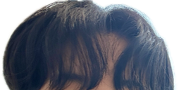 그림1.png 본인 머리 평가좀