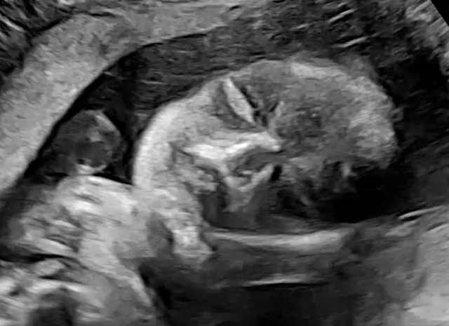 KakaoTalk_20240828_005138508.png 애국자 포 좀 받아보려고 왔습니다.