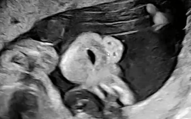 KakaoTalk_20240828_005153657.png 애국자 포 좀 받아보려고 왔습니다.