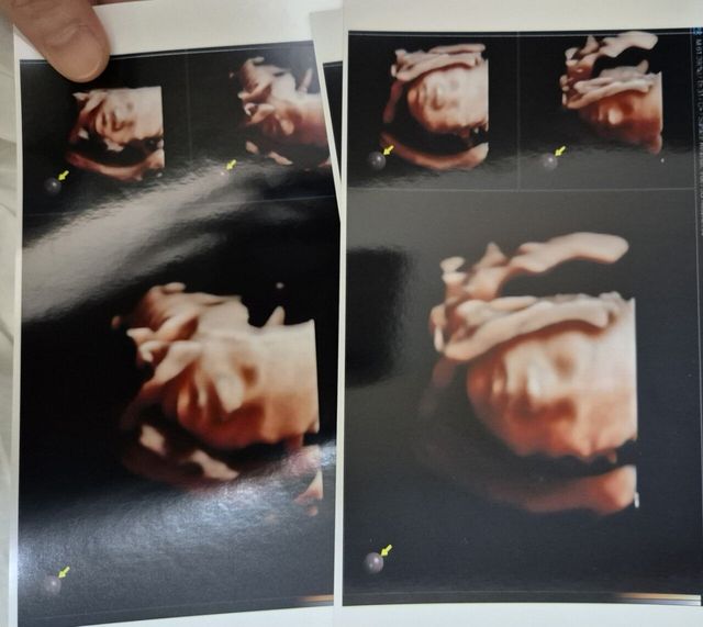 애국 펨붕이 우리 딸 올려본다