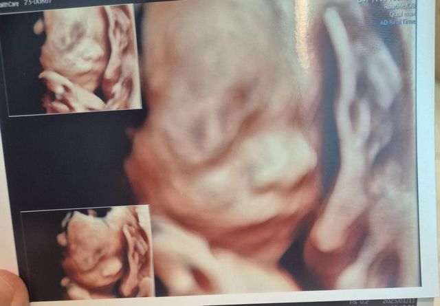 1000030864.jpg 둘째는 딸이다!!!!!!!!!!!!!!!