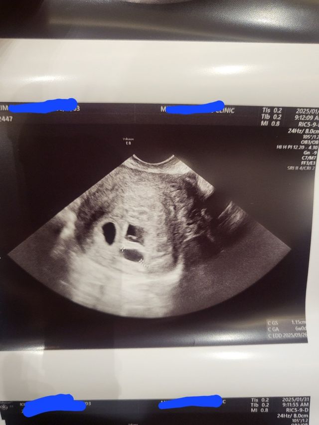 세쌍둥이 애국포 받으러 왔습니다.