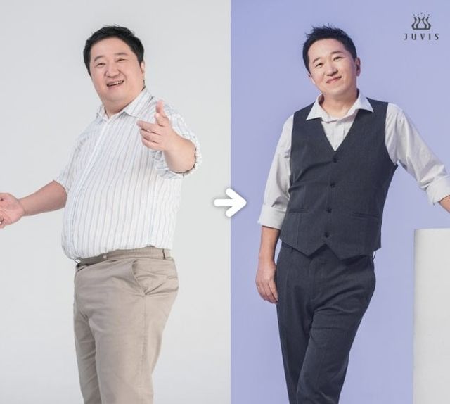 0003293950_001_20250106103109985.jpg 쥬비스로 21kg 감량했다는 정형돈