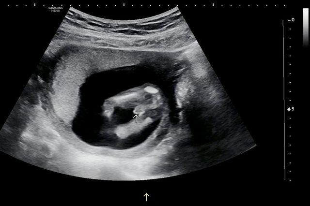 애국 후기 인증