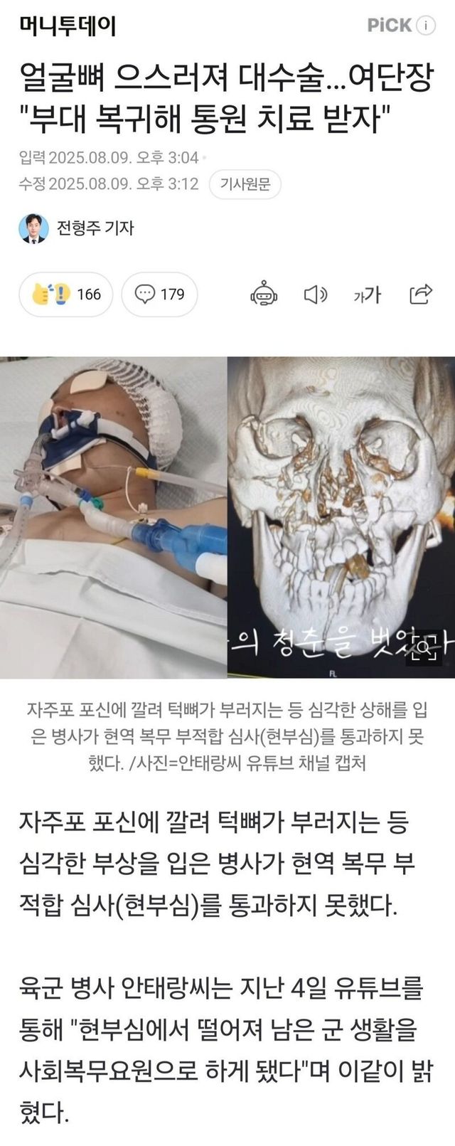 얼굴뼈 으스러져 대수술, 여단장 “부대 복귀해 통원치료”