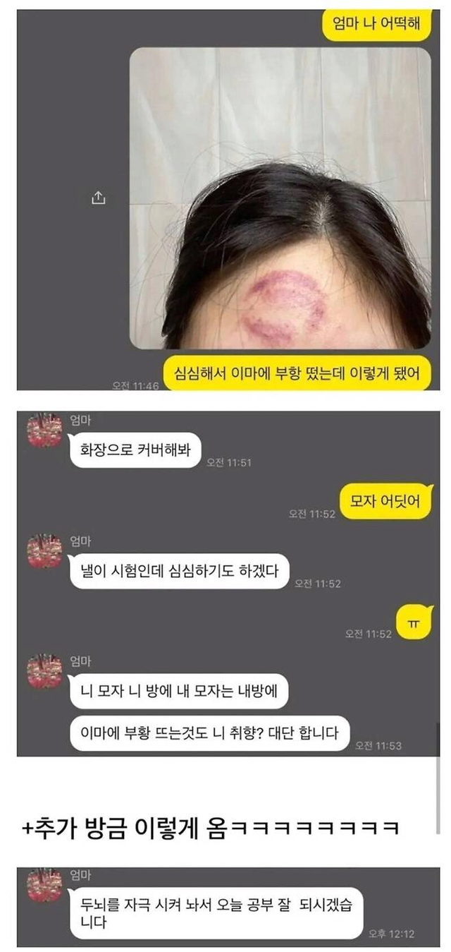 심심해서 이마에 부항 떠 본 여자.jpg