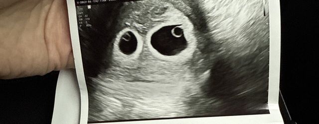 애국추 가능한가요