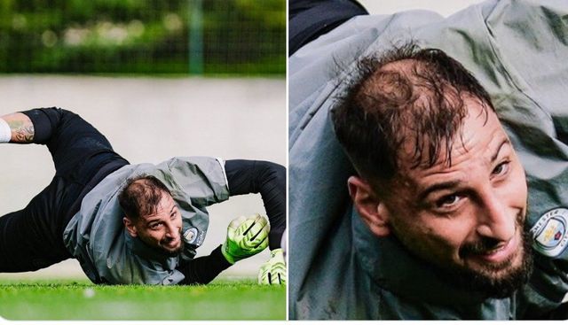 돈나룸마 탈모 근황.jpg