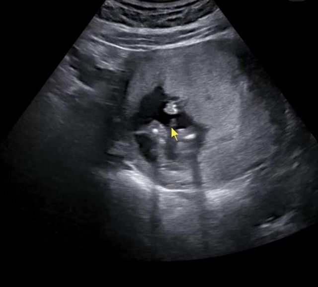 성별 나왔네요..!