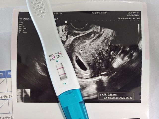 20250915_154331.jpg 알고 봤더니 두 줄.. !!??