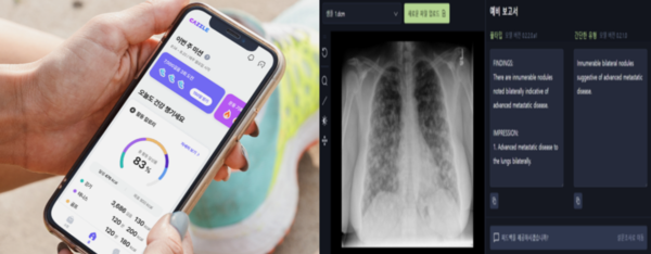 (좌)롯데헬스케어는 지난해 11월 개인맞춤형 건강 관리 플랫폼 캐즐 서비스를 종료하고, 12월 법인 청산을 결정했다. (우)카카오브레인이 보유했던&nbsp;생성형 AI기반 흉부 엑스레이 사진 판독 기술 '카라-CXR' 사업은 지난해 10월 스타트업 숨빗에이아이에 매각됐다. 사진=롯데헬스케어, 숨빗에이아이 홈페이지 캡쳐. [뉴스락 편집]