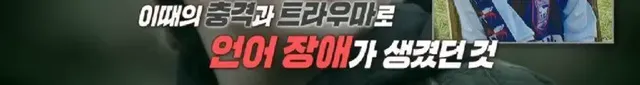 어린시절 머리색과 말 더듬으로 놀림 받던 에드 시런의 구원자 | mbong.kr 엠봉