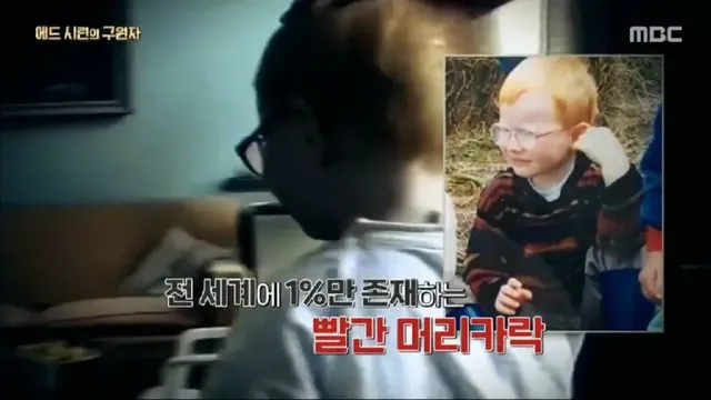 어린시절 머리색과 말 더듬으로 놀림 받던 에드 시런의 구원자 | mbong.kr 엠봉