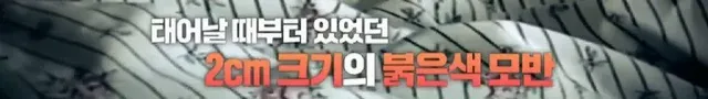 어린시절 머리색과 말 더듬으로 놀림 받던 에드 시런의 구원자 | mbong.kr 엠봉