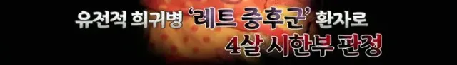 어린시절 머리색과 말 더듬으로 놀림 받던 에드 시런의 구원자 | mbong.kr 엠봉