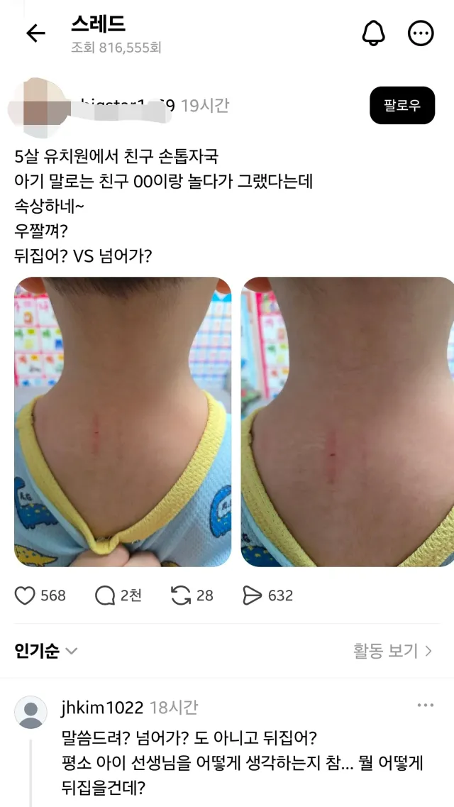 요새 왤케 애새끼 과보호하는 부모들이 많냐