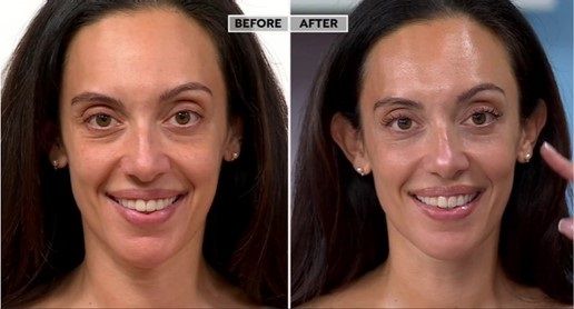 세라마이드 오로라 미스트 HSN 방송 실시간 비포·애프터(Before & After) 시연 결과