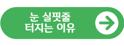 눈 실핏줄 터지는 이유