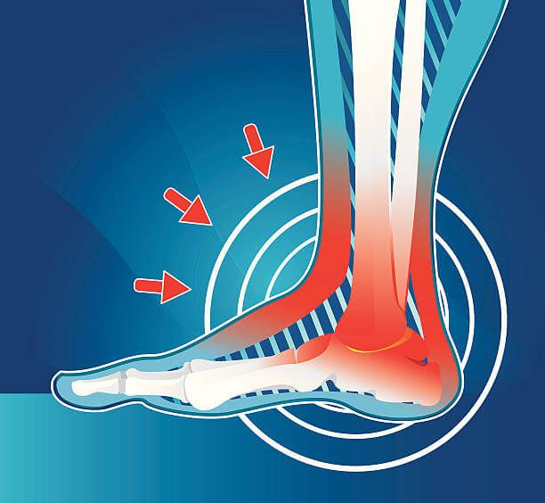 발 뒷축 통증 해결 방법