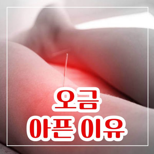 오금이 아픈이유 쉽게 알아보기
