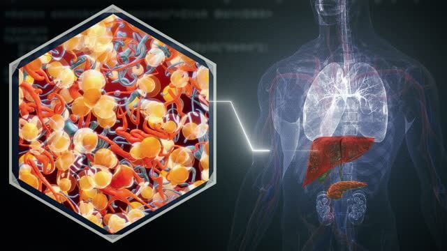 간암 초기증상 및 수치 및 간암에 좋은 음식