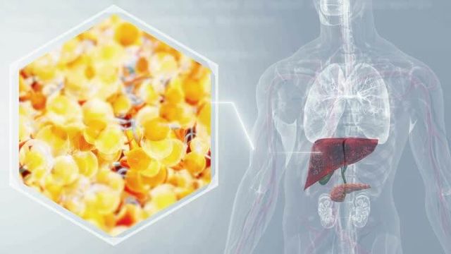 간암 초기증상 및 수치 및 간암에 좋은 음식