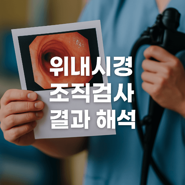 위내시경 조직검사 결과 해석 썸네일