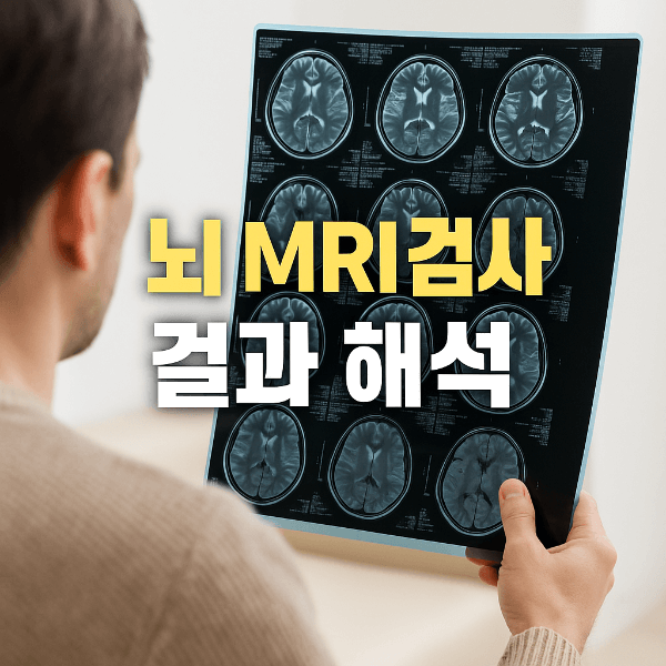 뇌 MRI 검사 결과 해석 썸네일
