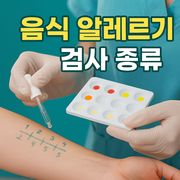 음식 알레르기 검사 종류 썸네일