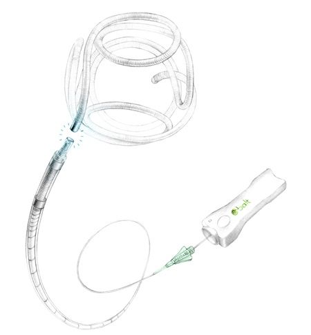 옵티마 코일 시스템. [사진=오스템임플란트 제공]
