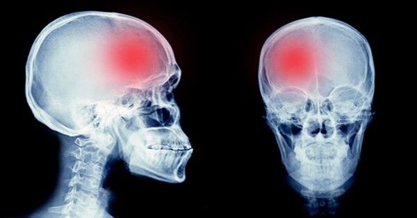 머리에 충격이 간 모습(사진=온라인 커뮤니티)