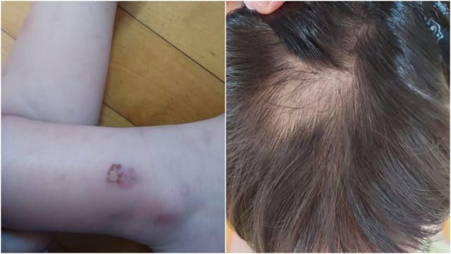 사진=온라인커뮤니티 캡쳐/부산일보