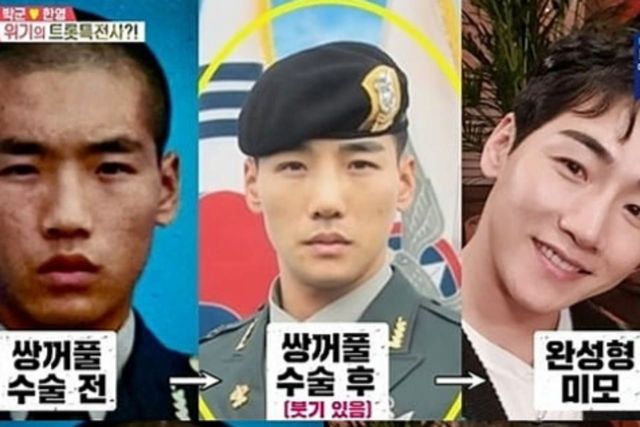 사진=SBS'동상이몽 시즌 2'제공