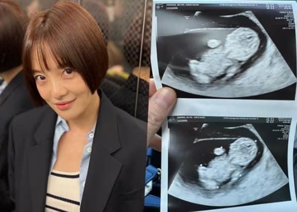 황보라 인스타그램