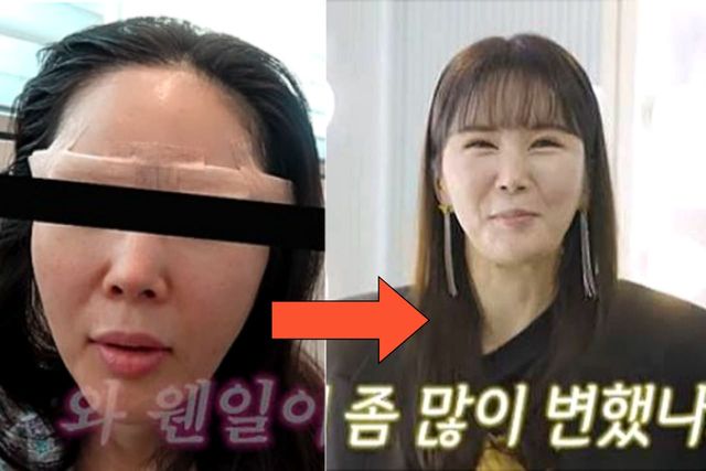 사진= 유튜브 채널 'A급 장영란