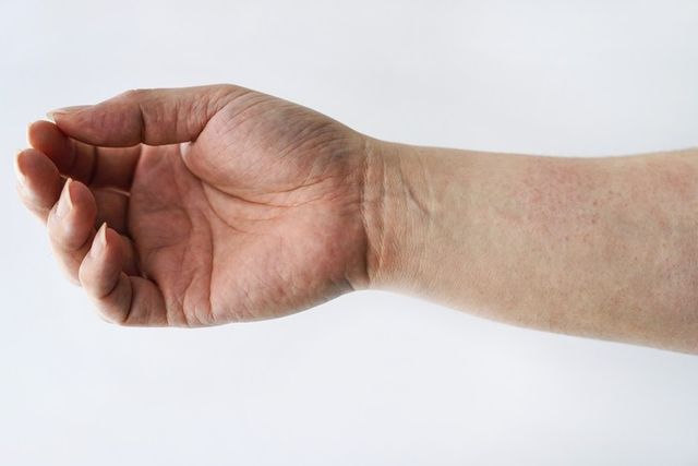 ⓒ게티이미지뱅크(건조한 피부)