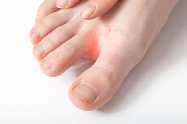 ⓒ게티이미지뱅크(발가락)