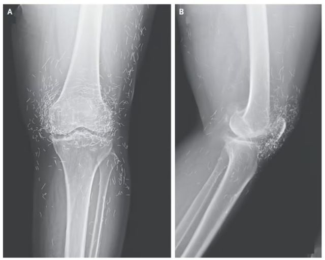 국제 학술지《뉴잉글랜드 의학 저널》