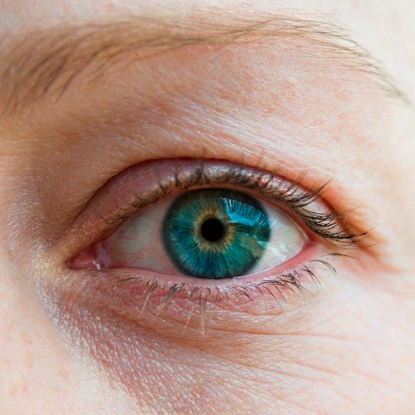ⓒ게티이미지뱅크(사람 동공)