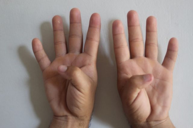 ⓒ게티이미지뱅크(엄지손가락 접기)