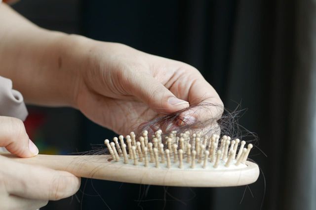 ⓒ게티이미지뱅크(탈모)