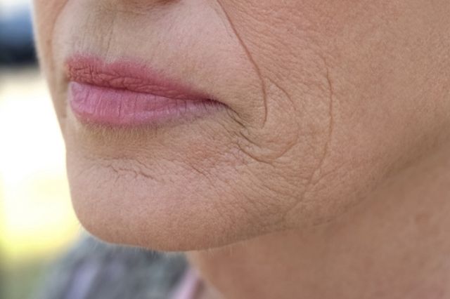 ⓒ게티이미지뱅크(주름)