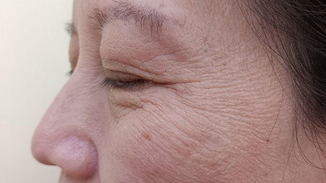 ⓒ게티이미지뱅크(주름)