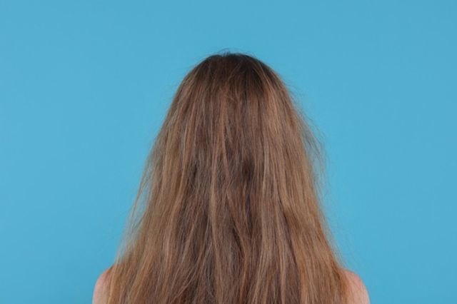 ⓒ게티이미지뱅크(푸석한 머리카락)