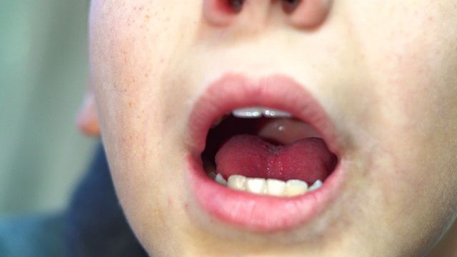 ⓒ게티이미지뱅크(혀와 치아)
