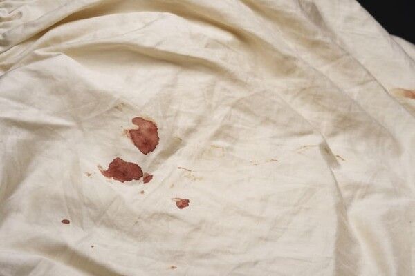 ⓒ게티이미지뱅크(피 얼룩)