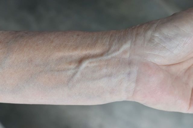 ⓒ게티이미지뱅크(혈관)