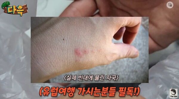 인천 빈대 사우나